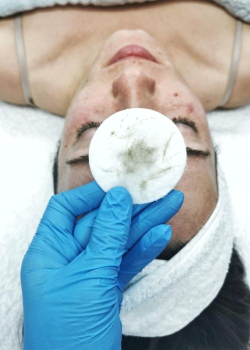 dermaplaning-eva-grifols